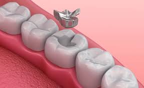 Restorative Dentistry